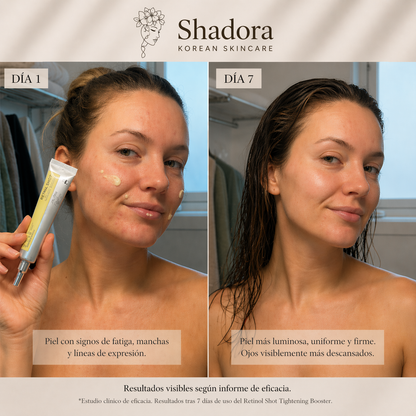 Shadora Sérum Vita A con Retinol – Efecto Lifting y Piel Lisa